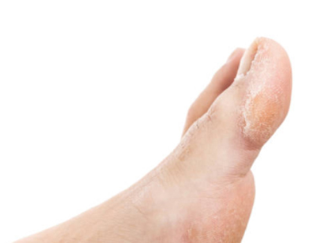 Foot Condition